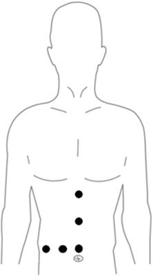Treatment of hepatic venous system hemorrhage and carbon dioxide gas embolization during laparoscopic hepatectomy via hepatic vein approach